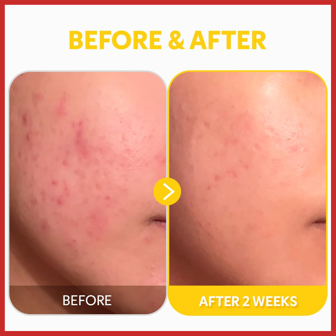 TIRTIR Pure Vitamin C24 Serum 30ml