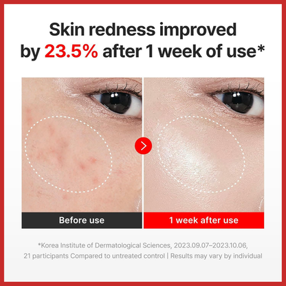Centellian24 Madeca Cream Time Reverse