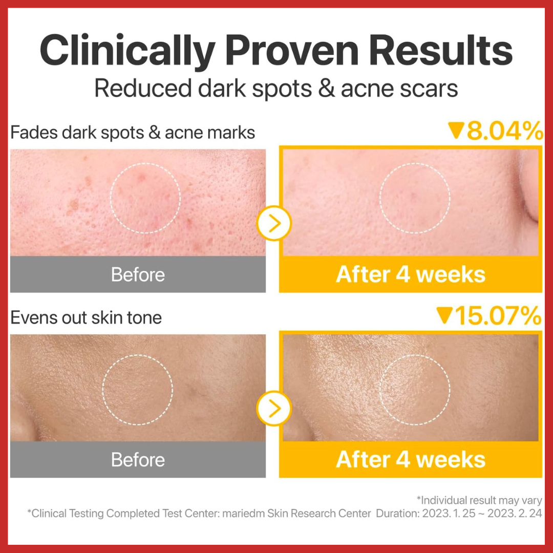 numbuzin No.5 Vitamin-Niacinamide Concentrated Pad 180ml (70Pads)