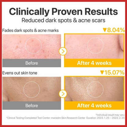 numbuzin No.5 Vitamin-Niacinamide Concentrated Pad 180ml (70Pads)