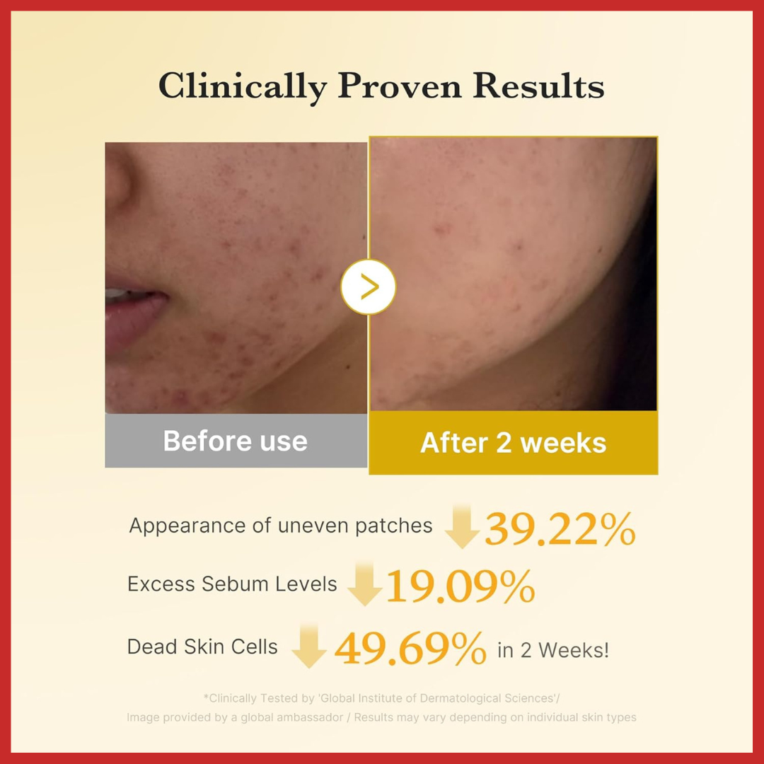 medicube Kojic Acid Turmeric Pad 70pcs