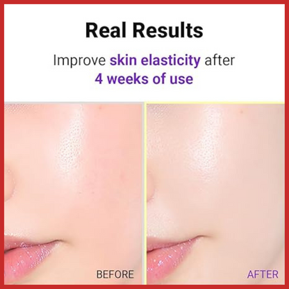 ISNTREE Hyper Retinol EX 1.0 Serum 20ml