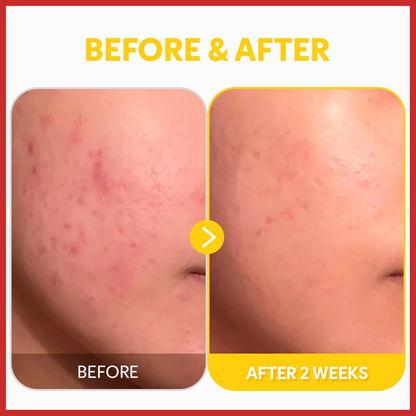 TIRTIR Pure Vitamin C24 Serum 30ml