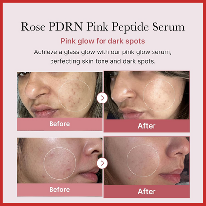 Medicube Collagen PDRN Pink Peptide Serum 30ml